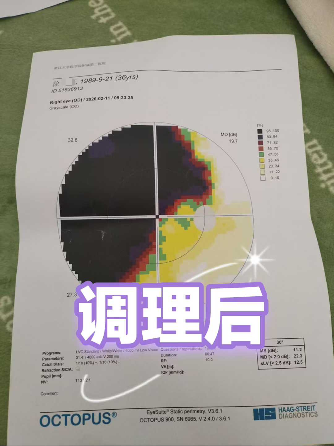 9.png